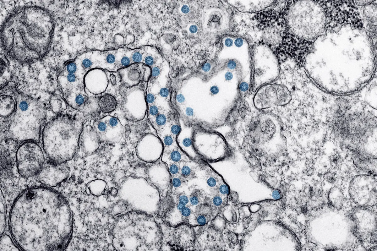 Ebola virus research