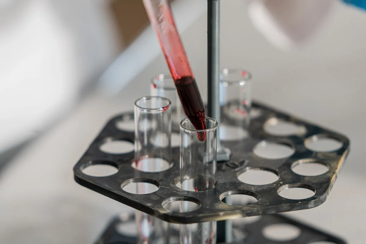 close-up of laboratory testing