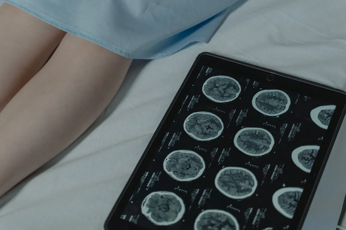 neurological condition diagram