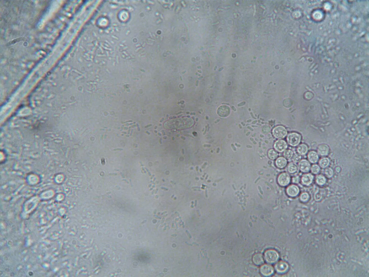 listeria bacteria under microscope