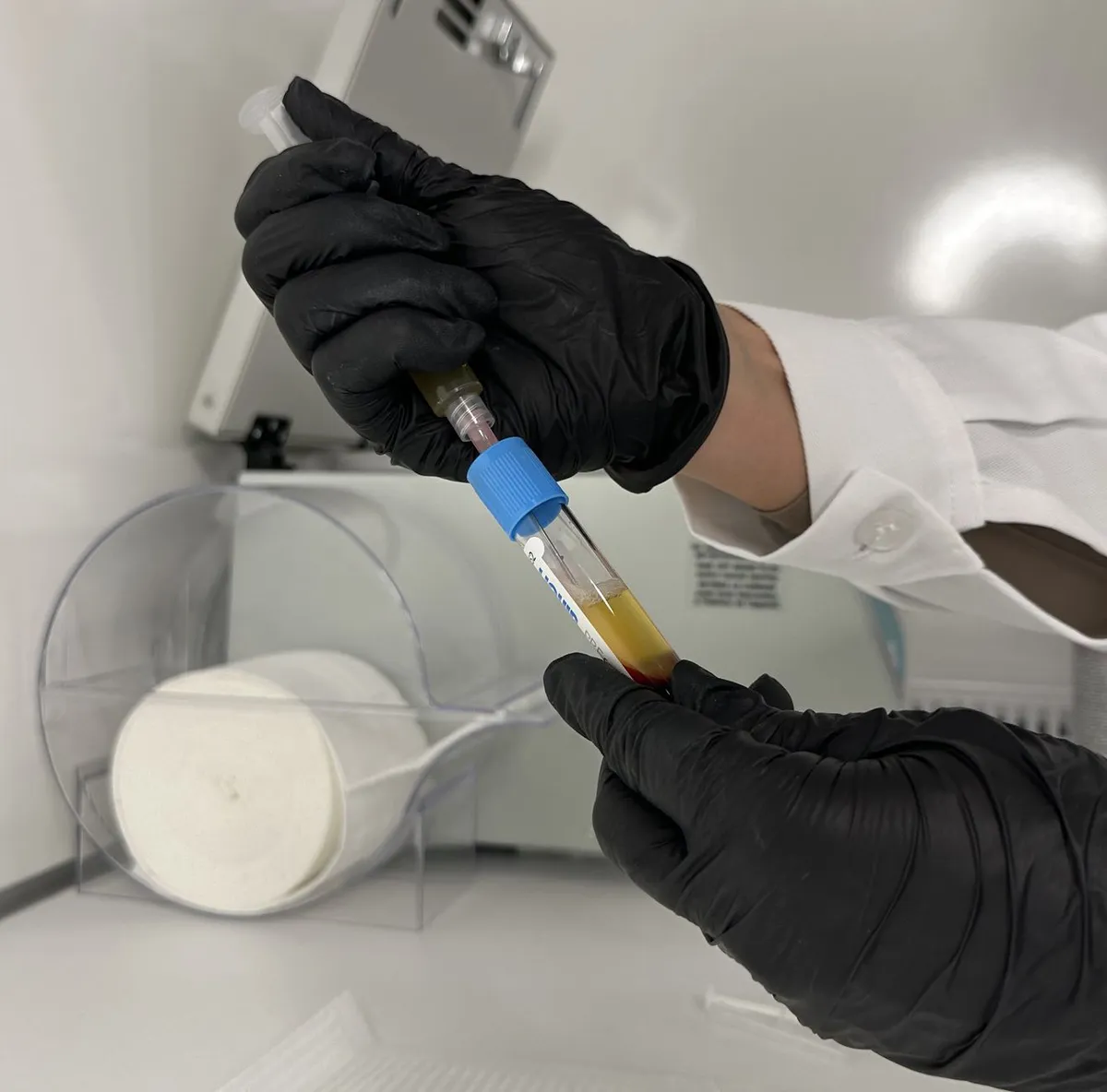 saliva sample collection