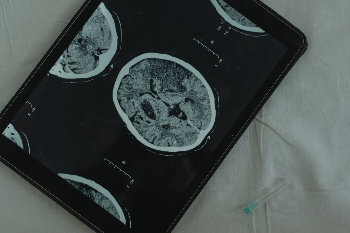 brain injury medical imaging