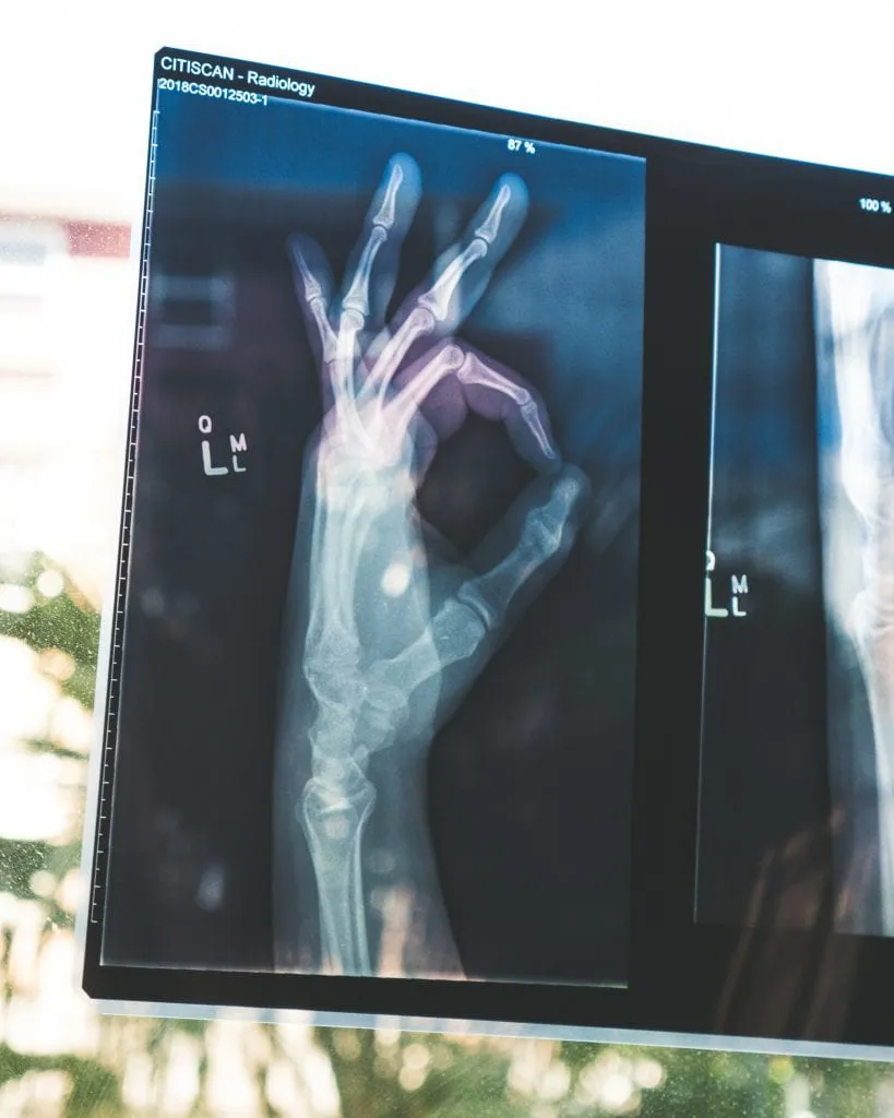 The Hidden Pressure to Appear Fine After an Injury: Navigating Recovery and Rights